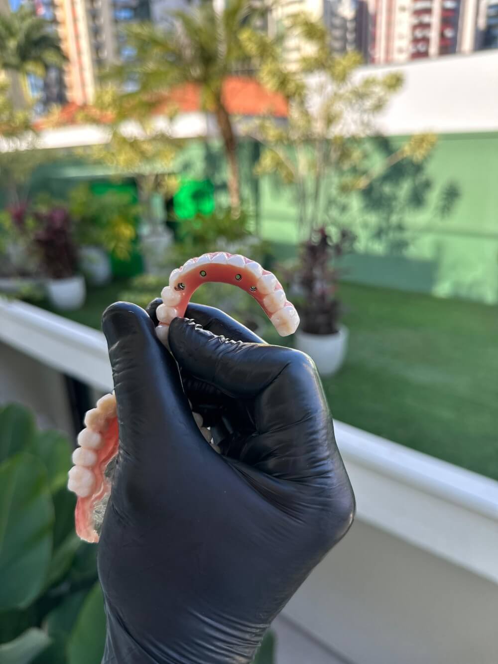 Especialistas em Implantes